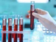 Влияние группы крови на предрасположенность к раку: новые открытия в исследовании