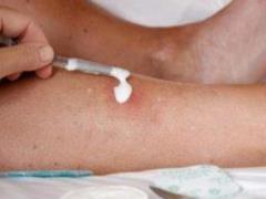 Effective methods of cleaning wet wounds: new and proven approaches