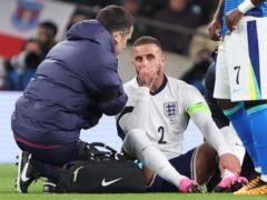 Guardiola: Doctor said that Walker will not play against Real Madrid, but