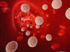 A side dish that reduces high cholesterol and zukor has been named