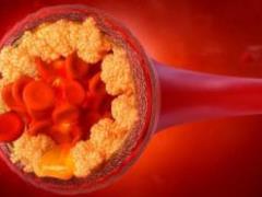 What products will help reduce cholesterol in the body