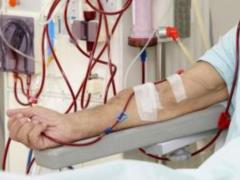 Dialysis: necessity and reality