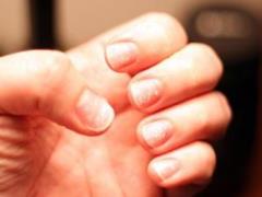 How to renew your nails after shellac: effective steps for the health of your nails