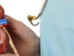 How our nirks signal about the need for brutalization to the doctor