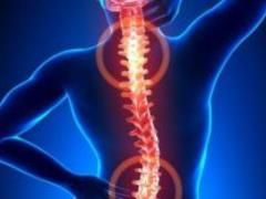 Lifetime speeches that will help you avoid osteoporosis