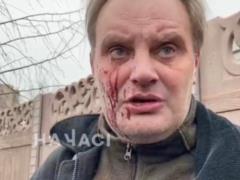 Missile attack on Krivoy Rog: a man lost his second wife during the war
