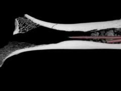 В ЮАР нашли наконечники стрел с токсинами 7000-летней давности