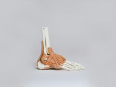 A sharp weight loss makes our bones fragile: scientists are looking for a potential solution to the problem
