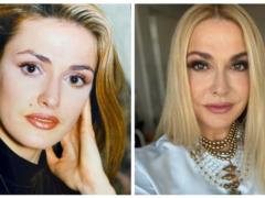 Сумская впервые призналась, почему удалила свою фирменную родинку на лице