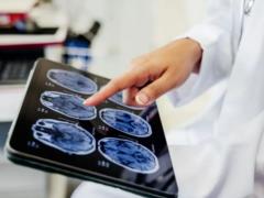 От постоянного переутомления мозг претерпевает анатомические изменения - исследование