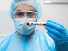 Hepatitis a in Kiwi: Experti Viyavili Jero infection