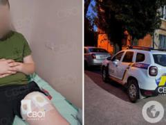  Услышали только свист : в Кривом Роге выстрелили в ногу ребенку на площадке.