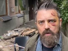 В Киеве на американца упал балкон - КМВА