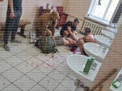 В Киеве мобилизованный порезал себе руки и шею на сборном пункте