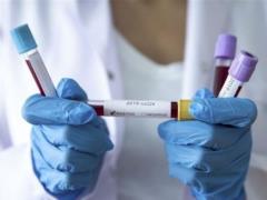 В Киеве резко выросло количество заболевших коронавирусом