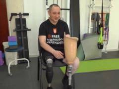 После ампутации и плена: защитнику Мариуполя установили один из лучших протезов в мире.