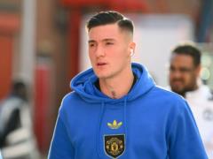 Шешко повернувся до тренувань Манчестер Юнайтед і сподівається зіграти проти Борнмута