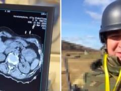 Были метастазы в печени: украинский пограничник поборол рак четвертой стадии и вернулся в строй.
