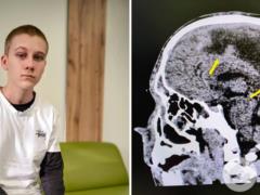 Впал в кому на следующий день после 16-летия: во Львове спасли подростка, который едва не погиб из-за гноя в мозге