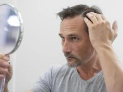 Почему мужчины лысеют: главная причина, о которой мало кто говорит