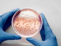 What s next for hantavirus: why don t we hear anything more