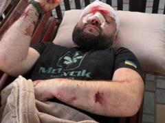 На Одесчине жестоко избили военнослужащего за замечание о русской музыке