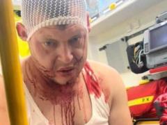 В Польше произошло очередное нападение на украинцев