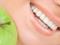 Зубная паста провоцирует распространение стойких бактерий