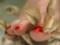 Небезпечна процедура: жінка після педикюру втратила нігті