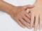 Пластичні хірурги: омолодження рук набирає популярність