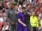 Розсічений лоб і 15 швів: футболіст  Ліверпуля  отримав страшну травму в товариському матчі