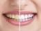 Чотири звички, від яких жовтіють зуби