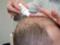 Scientists: the substance used in perfumery, struggles with alopecia