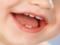 6 мифов о молочных зубах