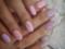 Загинаються нігті: причини і лікування