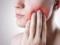 Зубная боль: причины и способы избавления