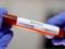 A citizen of an EU country died for the first time from coronavirus