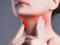 6 признаков, что ваша щитовидная железа плохо работает