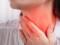 Боль в горле: как отличить вирусную инфекцию от сердечного приступа