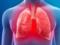 Лікар: як уникнути ускладнень на легені при COVID-19
