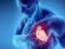 Ученые назвали способ спастись от смерти при сердечной недостаточности