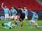 Манчестер Сіті - Боруссія М 2: 0 Відео голів та огляд матчу