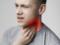 3 common mistakes in treating a sore throat