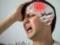 Названы пять отличительных особенностей головной боли при раке мозга