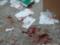 Избил врача и медсетру: под Харьковом на медиков больницы напал пострадавший в ДТП