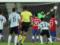 Аргентина — Чили 1:1 Видео голов и обзор матча