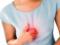 Инфаркт: изжога может быть признаком тихого сердечного приступа