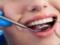 Хирург-имплантолог «Дентатэк» Геннадий Пермяков – о восстановлении зубов за одну процедуру по методике All-on-4