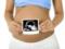 Безопасность и информативность УЗИ при беременности