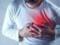 Кардіолог назвав ранні симптоми інфаркту